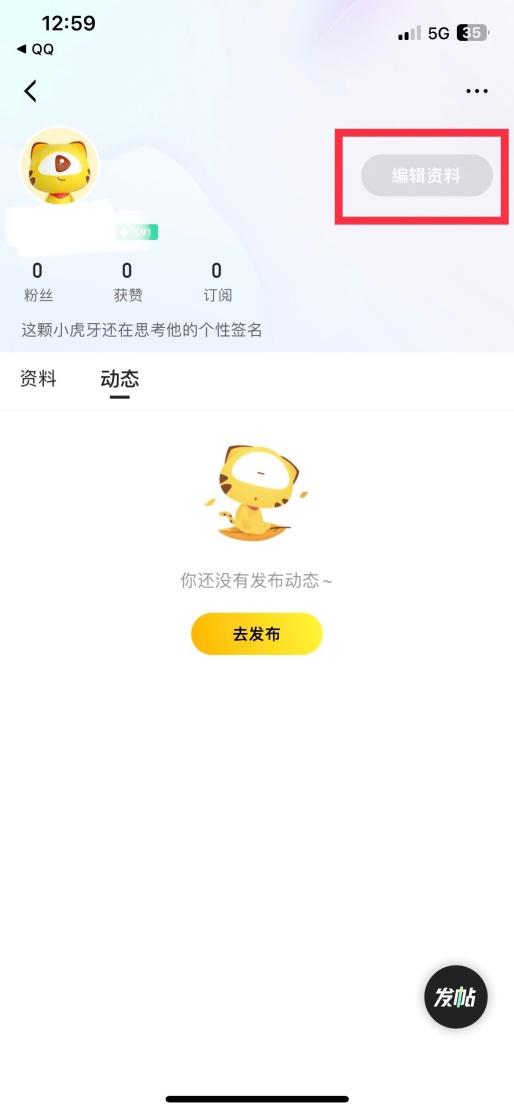 虎牙直播怎么改名字 用户昵称修改方法